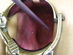 The girl helped the man to escape from the sad thoughts