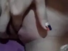 The brothers burned a bored friend